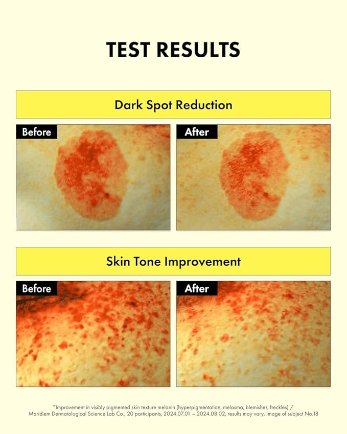 It'S SKIN Glutathione Shot B3 Anti Discoloration Serum 1.01 Fl Oz, 99% Pure Glutathione, Pepta-Glutazome, Dark Spot Corrector, Non-Irritating Daily Serum, Korean Skincare