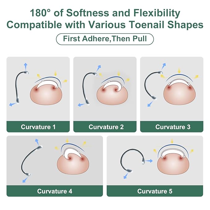 Dual Nitinol Ingrown Toenail Corrector,Ingrown Toenail Treatment,Curved Toenail Straightener,Ingrown Toe Nail Relief,Ingrown Toenail Removal Kit,Big Toe Ingrown Toenail Tool (0.55in,0.66in)