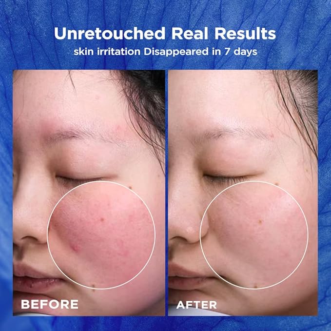 PSL Repair Moisturizer II-Daily Moisturizer Face Cream with Ceramides for Dry & Sensitive Skin, Hydrates, Strengthens Skin Barrier, Calms Redness and Irritation, Anti-aging