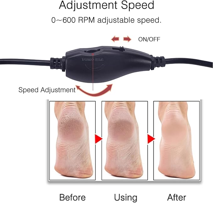 Electric Callus Remover, Foot Sander, Enhanced Pedicure Tool with Speed Controller and 60 Spare Sanding Discs for Men and Women, removes calluses, Dead and Dry Skin, Pink and Black Color. (Black)