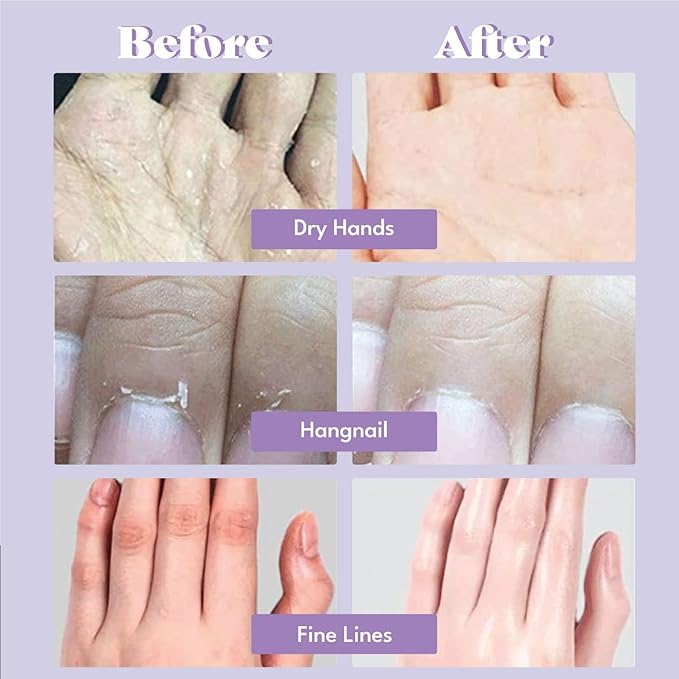 Extra Silky Hand Mask 5 Pairs, Moisturizing Gloves for Dry Hands with White Truffle, Green Caviar & Peptides, Repairing and Softening Hand Care Treatment for Aging, Cracked, and Dry Skin