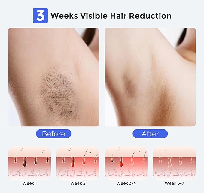 LUBEX Smart Permanent IPL Laser Hair Removal for Woman and Men, Painless Sapphire Ice-Cooling, Alternative to Salon, Bikini Shaver, Facial Epilator for Armpits Back Legs Arms Face Bikini Glow 6 A+