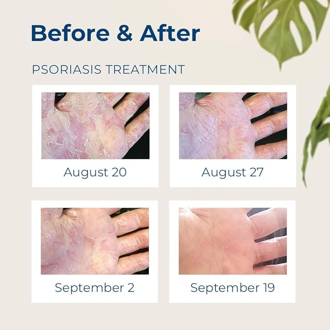 Gloves In A Bottle 32 oz Refill Pouch – Unscented Shielding Lotion | Fast Relief for Dry, Cracked Skin & Eczema | Non-Toxic, Hypoallergenic, Fragrance-Free Hand & Body Moisturizer – Bulk Size