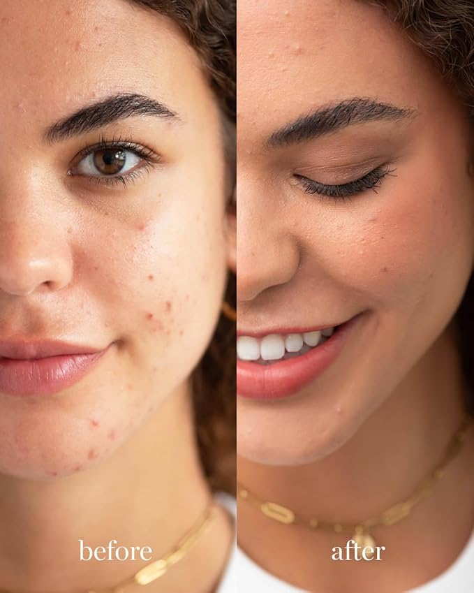 Ere Perez - Natural Arnica All-Cover Pot Concealer | Med-Full Coverage, Satin Finish, Calming, Nourishing | Vegan, Cruelty-Free, Clean Beauty (Brew, 0.18 oz | 5 g)