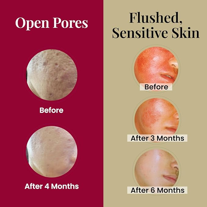 LABO Nutrition Le Revital 98% Concentrated Nano Placenta Extract, Umbilical & Sodium Hyaluronate, Anti-aging Serum from Japan, Skin Rejuvenate Essence, Reduce Wrinkles + Hydration, Non-greasy