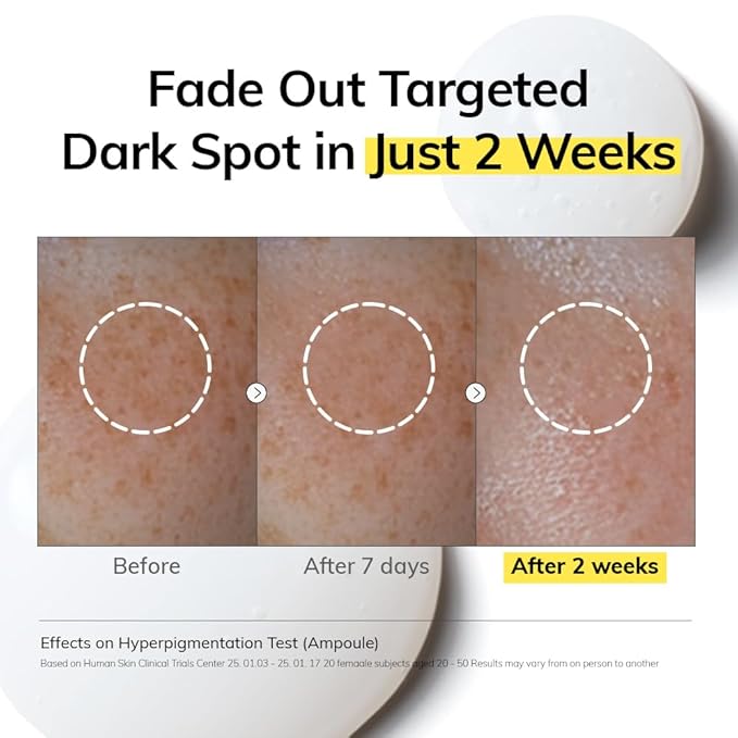 MIMUMIMU Niacinamide 10%+Thioctic Acid 100 ppm NIACINDY Facial Glow Ampoule for Dark Spot After Care - Daily Korean Potency Skincare - Uneven Tone, Hyperpigmentation, Discoloration Roll-on Ampoule