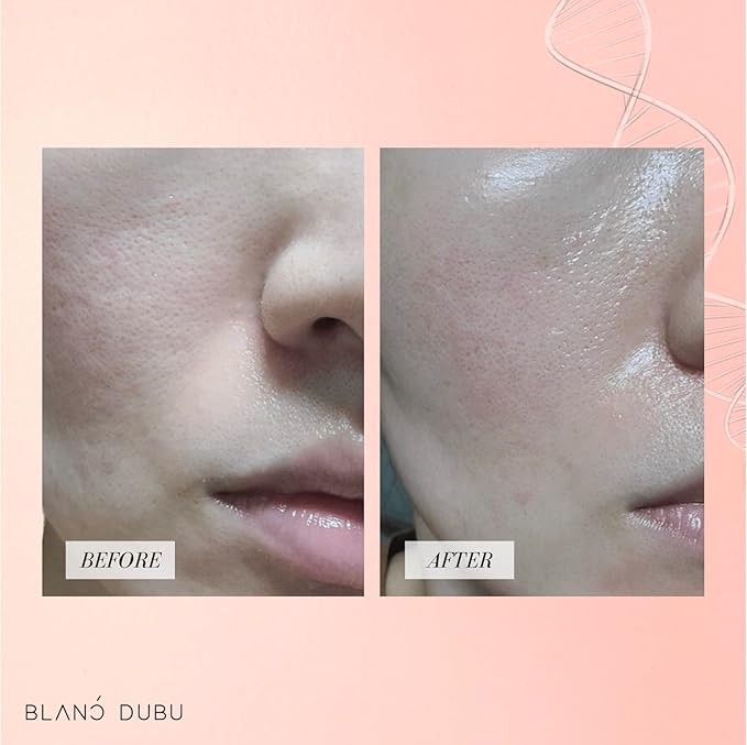 NUBORN CELL Hydrogel Collagen Mask | Advanced Stem Cell Face Mask for Dry Skin | 2% Niacinamide, Peptides, Collagen, and Hyaluronic Acid | Made in Korea, (4 masks) Pack of 1