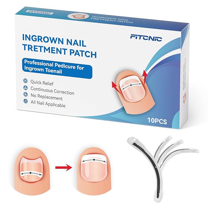 Titanium Alloy Ingrown Toenail Treatment, Ingrown Toenail Removal Kit Specially Designed for Curved Nail Repair and Ingrown Toenail Corrector Kit