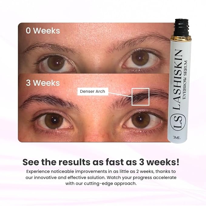 Eyebrow Growth Serum - Enhances Thicker Brows in 2-4 Weeks | For Thin, Patchy & Over-Tweezed Brows - Fast Absorbing | Grows Brows Faster, Longer & Fuller - (3mL)