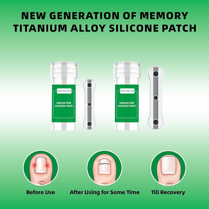 Ingrown Toenail Treatment, Nails Corrector Tool, Professional Toenail Correction Remover Repair Removal Kit for Rapid Relief