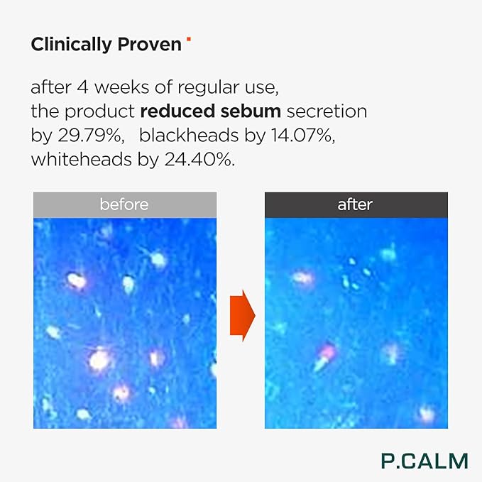 P.CALM Barrier Cycle Toner – Azulene & Centella Asiatica for Deep Hydration & Skin Barrier Strengthening, Korean Vegan Facial Toner for Sensitive Skin (200ml / 6.76 fl.oz)