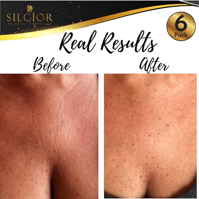 6 PACK Anti Wrinkle Chest Pads, Decollete Pads for Chest Wrinkles, 2 Silicone Chest Wrinkle Pads, Reusable Silicon Chest Patches, Wrinkle Sleeping Pads, Cruelty-free (6 Pack)