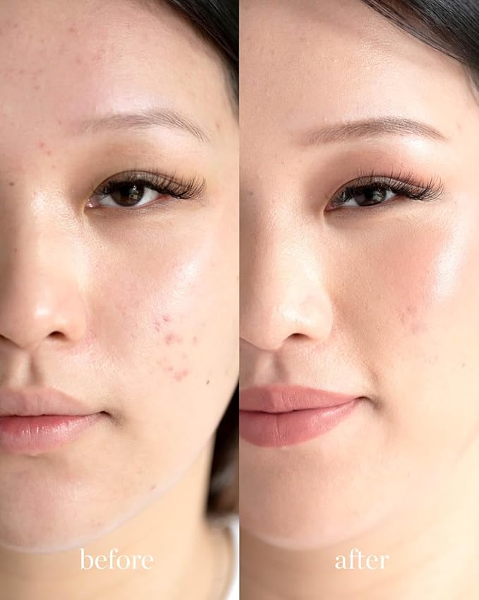 Ere Perez - Natural Arnica All-Cover Pot Concealer | Med-Full Coverage, Satin Finish, Calming, Nourishing | Vegan, Cruelty-Free, Clean Beauty (Honey, 0.18 oz | 5 g)