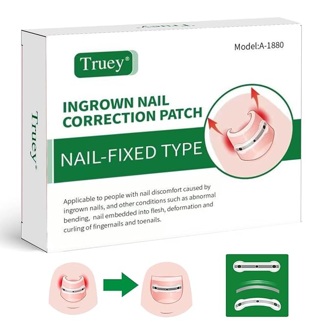 Titanium Alloy Silicone Ingrown Toenail Treatment, correction patch, Ingrown Toenail Corrector, Nail correction tool,Ingrown Toenail Removal Kit,Cuttable Applicable for any nail size,Reusable