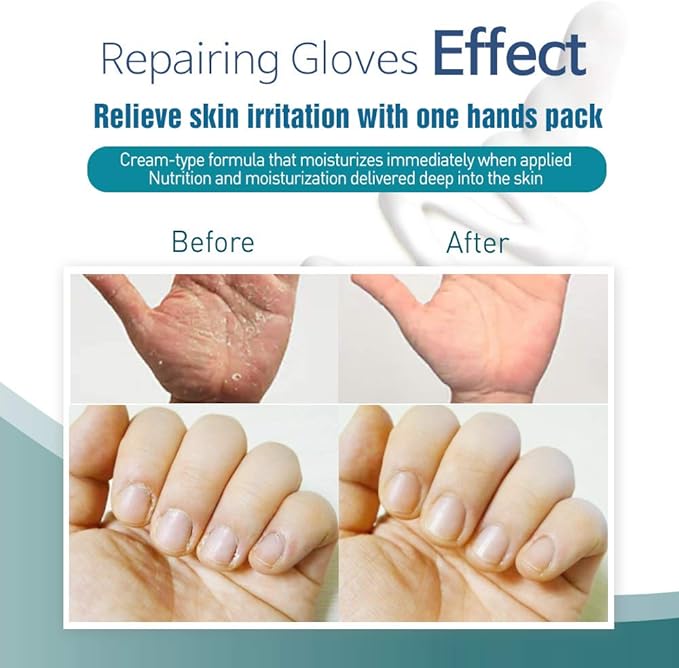 Epielle Intensive Repairing Hand Masks (Gloves-6pk) for Dry Hands Spa Masks | Coconut Oil + Milk Extract + Hyaluronic Acid | Skincare Gifts | Skincare Party Favors, Mother's Day Gifts