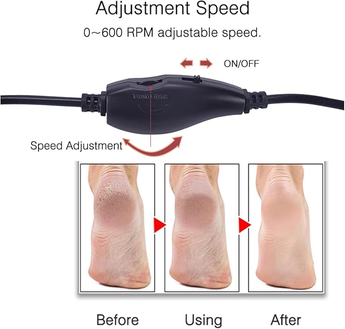 Electric callus remover, foot sander, enhanced pedicure tool with speed controller and 60 spare sanding discs for men and women, removes calluses, dead and dry skin, pink and black color.