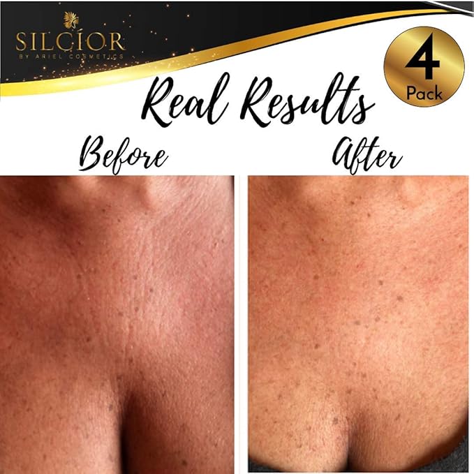 SILCIOR 4 PACK Chest Wrinkle Pads, Silicone Chest Wrinkle Pad, Decollete Anti Wrinkle Chest Pads, Chest Wrinkle Pads Sleeping Reusable, Chest Patches for Wrinkles, Smoothing Pads