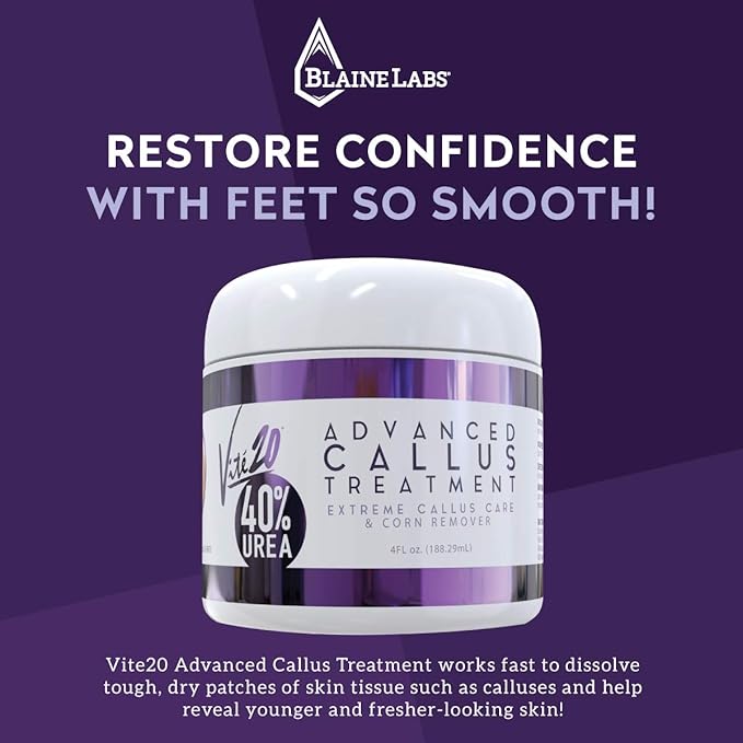 Blaine Labs: Vite20 Advanced Callus Treatment - Extreme Callus Remover for Feet - 4 oz. - Advanced Skin Care for Dry, Cracked Feet - Great for Foot Spa and Pedicure Kits - 40-percent Urea - Works Fast