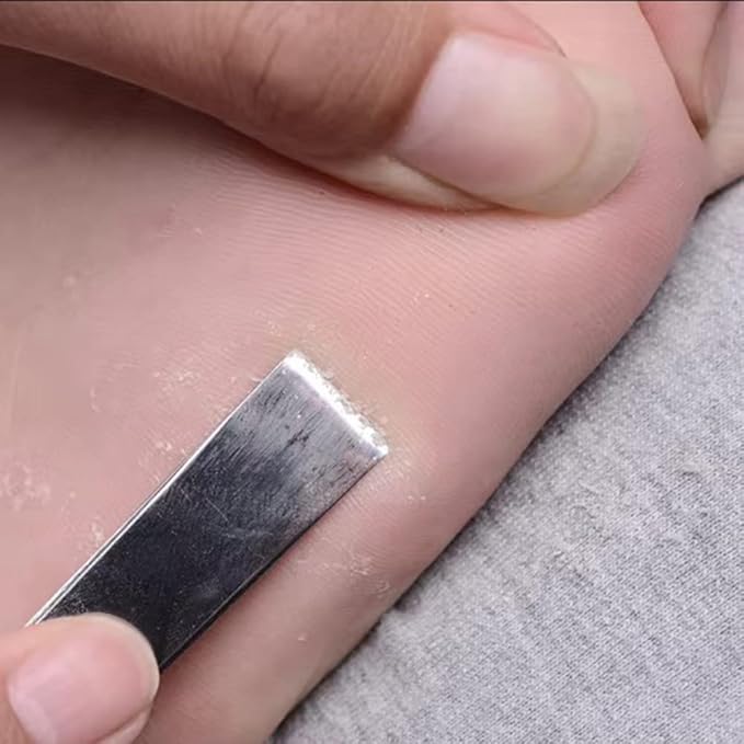 Callus Remover for Feet,8PCS Pedicure Knife,Corn Removers for Feet,Callus Remover,Foot File Pedicure Set, with Storage Box