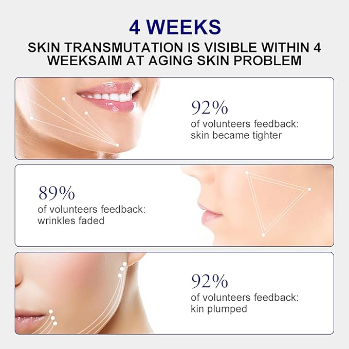 Retinol Serum for Face, 2.5% Retinol Intense Night Serum with Squalane,Vitamin C & E & B3,Hyaluronic Acid for Lines, Wrinkles & Premature Sun Damage to Resurface & Hydrate 30 ml/ 1 Fl oz