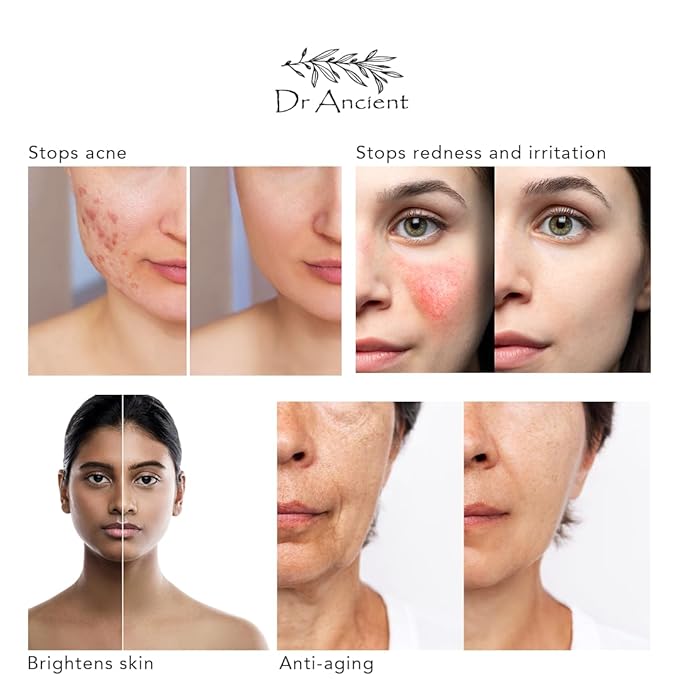 Argan Soap Bar Organic Natural Vegan Traditional Handmade Antique - Anti-Aging For Women And Men, Anti-Wrinkle - No Chemicals, Pure Natural Soaps!