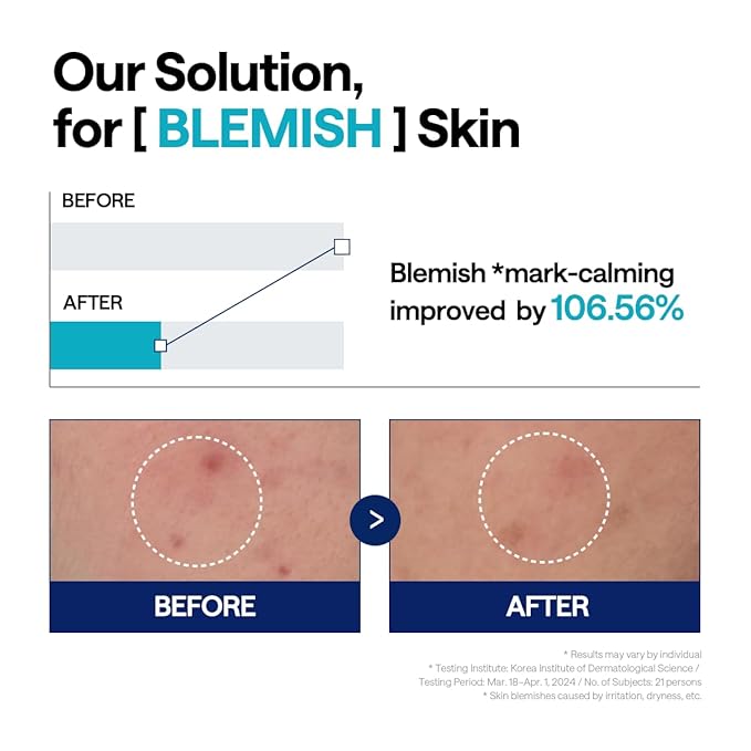 Mediheal Madecassoside Repair Serum 1.35 fl.oz - Blemish Care, Fades Pigmentation and Freckles & Skin Soothing & Hydration - with Centella Asiatica, Niacinamide