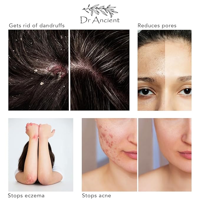 Stinging Nettle Soap Bar Organic Natural Vegan Traditional Handmade Antique - Anti-Dandruff, For Acne, Peeling, Healthy Hair - No Chemicals, Pure Natural Soaps!