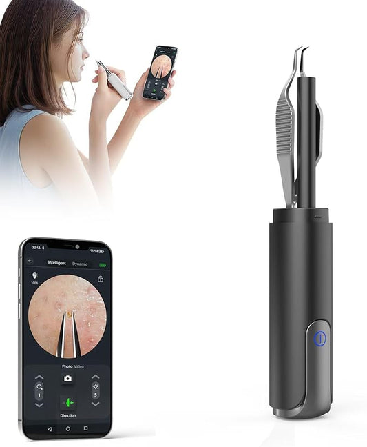 Blackhead Removal Tweezer with 1080p Camera, Ultimate Precision: Tweezer with Camera - Perfect for Delicate Tasks! - - Ingrown Hair, Ear Hair Tweezer (Black)