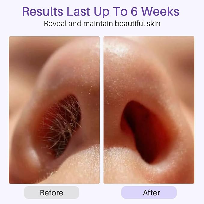 BLITZWAX Brazilian and Bikini Waxing Pot for Men, Hard Wax Warmer for Face, Legs, and Body, At Home Hair Removal Kit, Beginner Friendly, Quick Heating, Precise Temperature Control