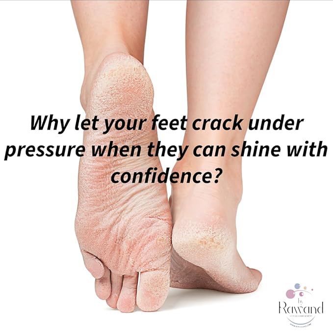 Organic Deep Foot repair with Hyaluronic Acid & Cocoa Butter With Vitamin E Handmade Heel Heal For Cracked Heels and Dry Feet Enriched With Shea & Kokum Butters