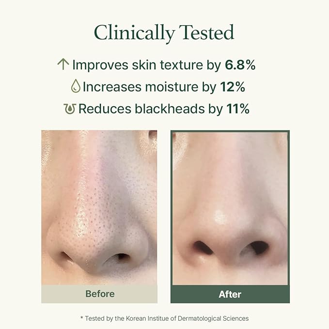 Korean Rice Mochi Face Cleanser Best Set [Fresh Green + Rosehip + Blue Hyssop + Calendula] - Deep Pore Cleansing, Acne Face Wash, Blackhead Remover for Sensitive & All Skin Types