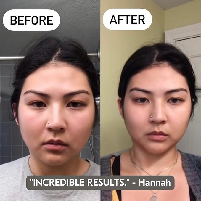 Mount Lai Jade Facial Spa Set, Jade Roller and Gua Sha Facial Tools Set, Guasha Tool for Face to Relieve Muscle Tension and Reduce Puffiness, Anti Aging Skin Care Sets for Women