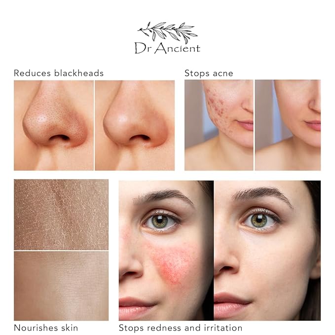 Aloe Vera Soap Bar Organic Natural Vegan Traditional Handmade Antique - Rejuvenate Your Skin Naturally! Absolutely No Chemicals! Pure Natural Soap!