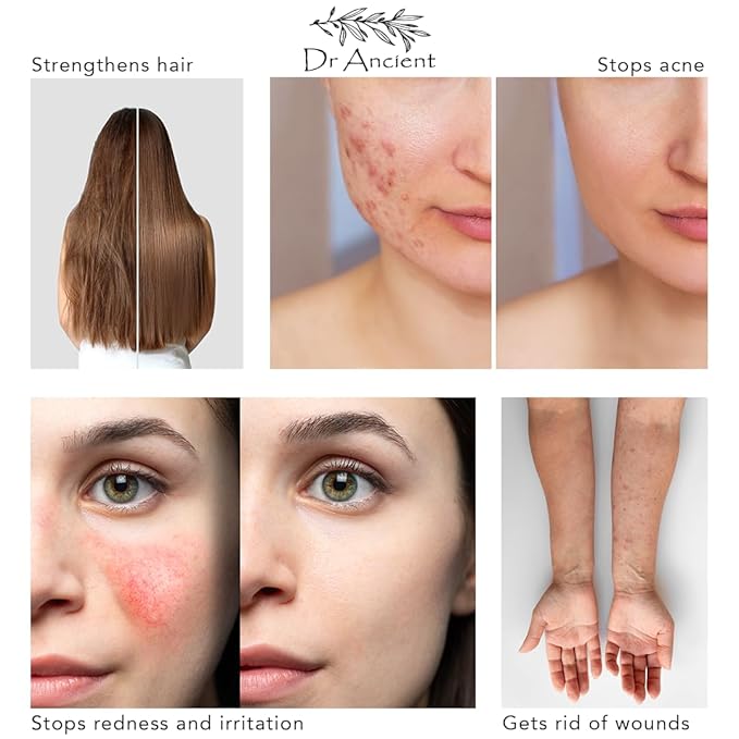 Kantaron St. John'S Wort Soap Bar Organic Natural Vegan Traditional Handmade Antique - Effective For Nappy Rash, Minor Burns, Healing In The Wounds - Absolutely No Chemicals!