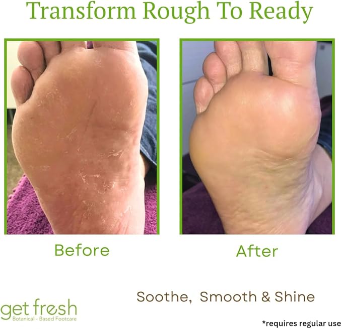 Get Fresh Rescue Me - Intensive Foot Cream for Dry Skin, Cracked Heels, and Calluses, with Shea Butter, Aloe, and Lemongrass, 170g