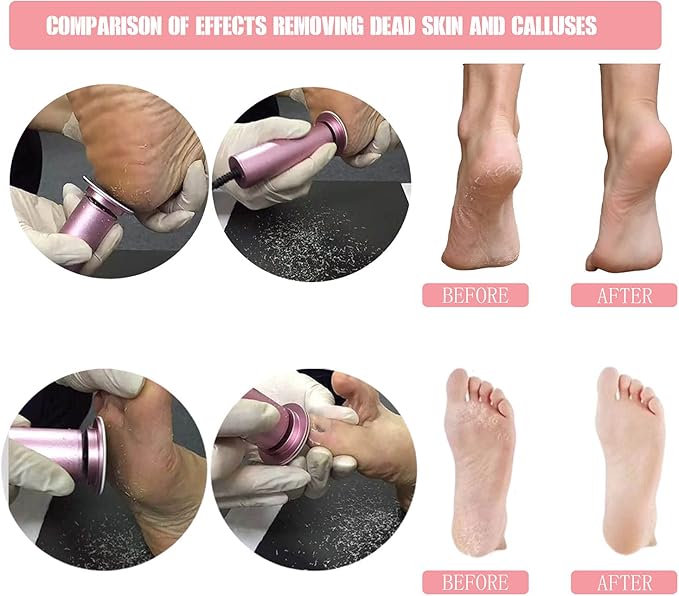 Electric Foot File Callus Remover Professional Foot File Pedicure Tools Adjustable Speed 120pcs Replacement Sandpaper disc Easy to Remove Cutin Dead Skin calluses(Black 120pcs)