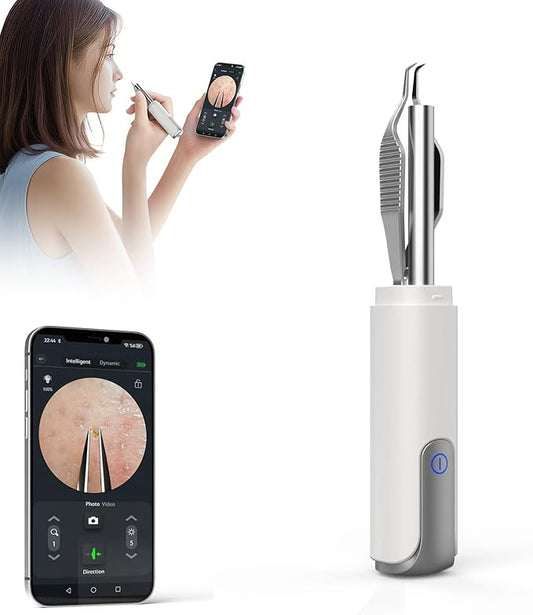 Blackhead Removal Tweezer with 1080p Camera, Ultimate Precision: Tweezer with Camera - Perfect for Delicate Tasks! - - Eyebrow Tweezer, White Hair Tweezer (White)