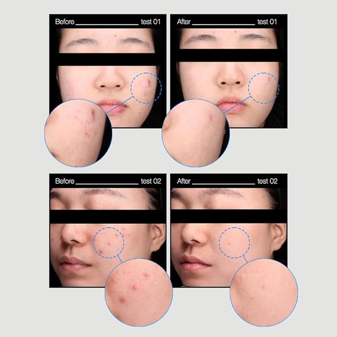 Skin-FIT Water, Pore-Refining & Tightening, Gentle Pore Care, Balancing & Hydrating, Oil-Controlling, 8.96fl.oz/265ml