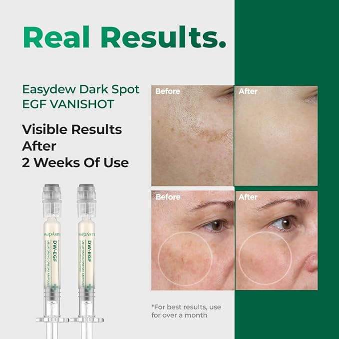 EASYDEW DW-EGF Melatoning One-Day Ampoule - Dark Spot Correcting Korean Facial Serum for Uneven Skin Tone & Dull Skin with EGF, Glutathione, Niacinamide - Age Defying Skincare, 0.03fl oz x 7ea