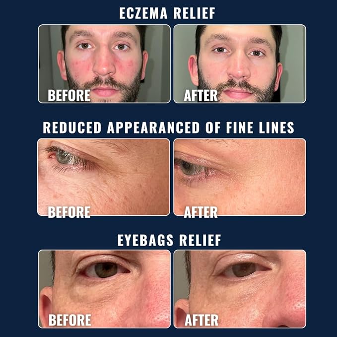 Prettyboy Face Revival Gel Moisturizer For Men - Hydrating Cream That Refreshes Dry Skin, Irritation, & Redness - Supports Anti Aging & Anti Wrinkle - Fragrance Free - 3 Count