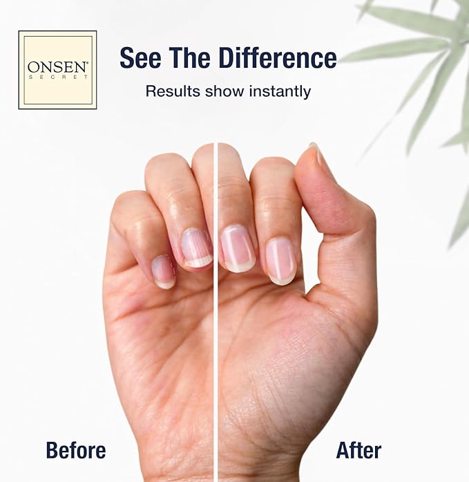 Onsen Secret Complete Nail Reboot Kit w/Nail Reboot Oil 10ml, Nail File 120/180 Grit Double Sided, A 3-Way Nail Buffer Block & Cuticle Serum-15ml w/Cuticle Oil in Action-Super Value Pack