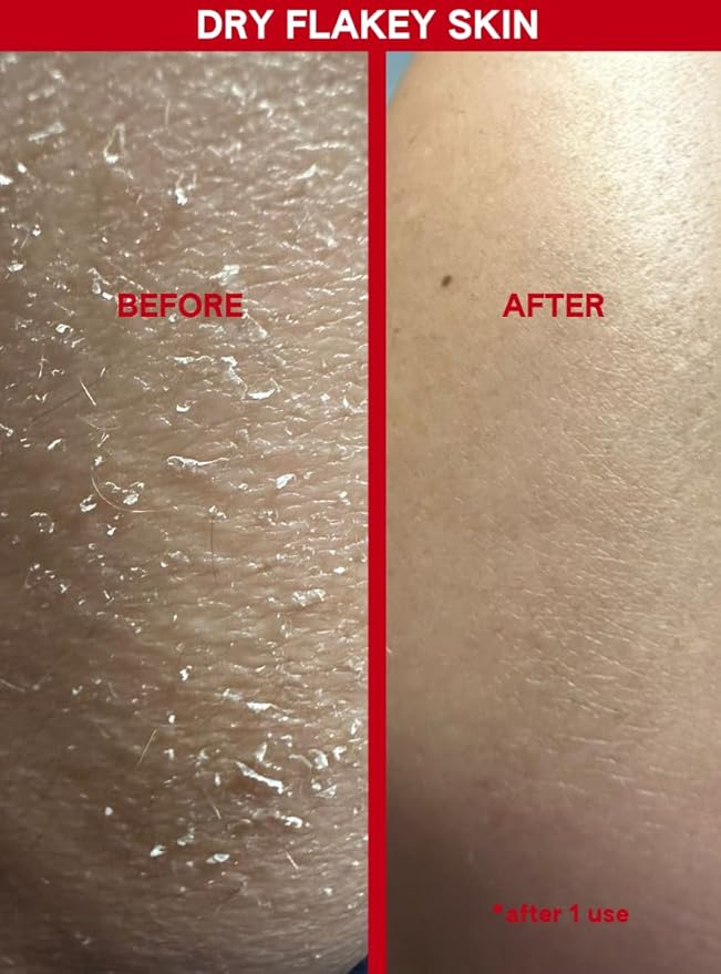 ABI AMÉ Soft-Touch Chemical Body Exfoliant - Smoothing and Softening Pre-Shower Body Mask - 30% AHAs + 2% BHAs, Safe for Sensitive Skin - 150ml/5.1 Fl oz