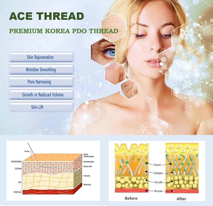 ACE PDO thread lift KOREA face/whole body - Mono Type (100pcs) - 11 sizes (30G25)