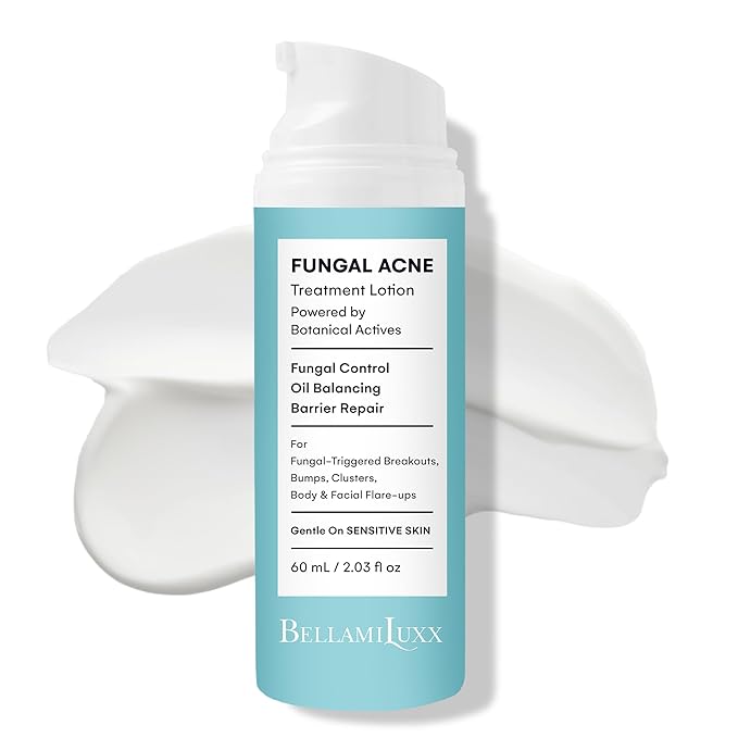 Fungal Acne Treatment Lotion: Effective Face & Body Pimple Cream for Bumps, Clusters, Itch & Redness – Fungal Prone Skin Acne Treatment Moisturizer for Teens & Adults with Natural Actives