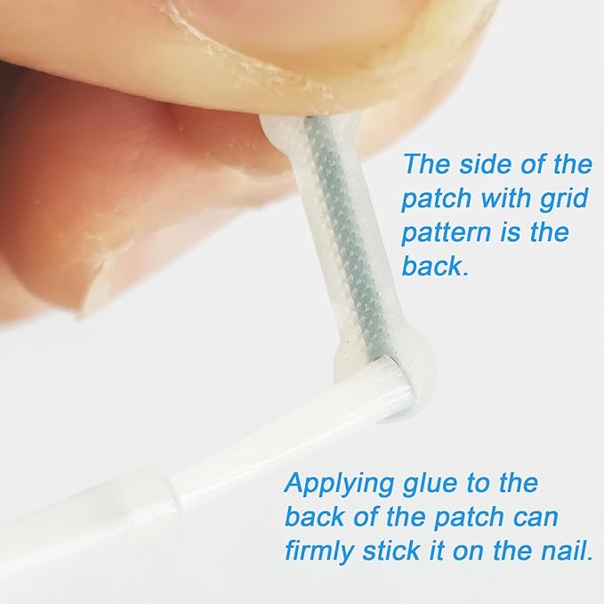 Titanium Alloy Silicone Ingrown Toenail Treatment, correction patch, Ingrown Toenail Corrector, Nail correction tool,Ingrown Toenail Removal Kit,Cuttable Applicable for any nail size,Reusable