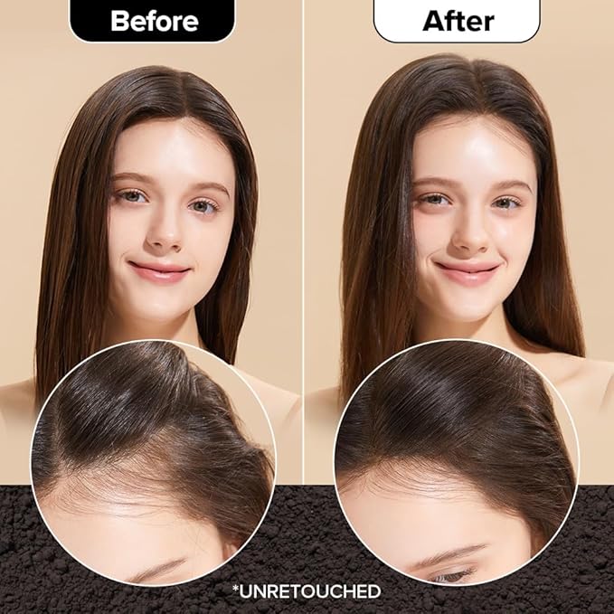 I DEW CARE Biotin Clarifying Dry Shampoo - Tap Secret Dark Brown Duo Set | Strengthening & Volumizing, Powder Type, Refillable, Travel size, Non-aerosol, Mother's Day, 0.24 Oz * 2ea