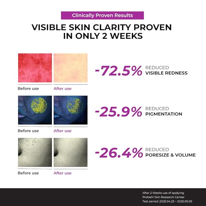 JUMISO Niacinamide 10 Serum - Korean Face Serum with Glutathione, TXA Tranexamic Acid and Centella Complex - Reduces Pigmentation, Evens Skin Tone, Soothes for Sensitive Skin, 1.35 fl.oz.