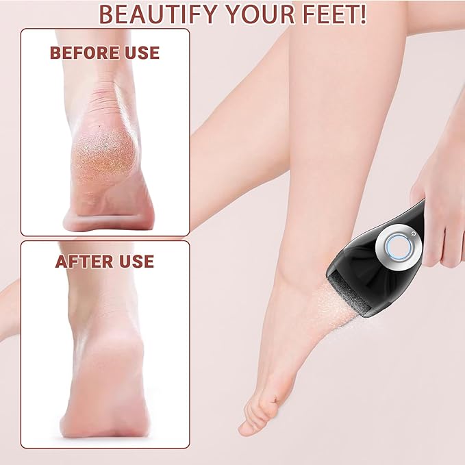 Upgraded Rechargeable Foot Callus Remover, Professional Electric Foot File, 10 in 1 Pedicure Tools Foot Care Kit Pedi Feet Care for Dead, Hard Cracked Dry Skin Ideal Gift (Black)