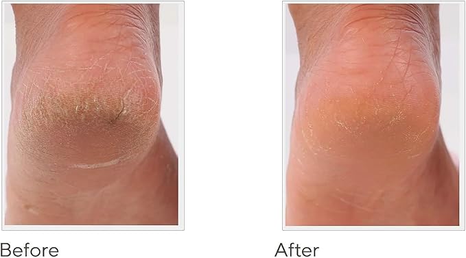 Spa-Rific 3pc Nano File Set: Professional Heavy Duty Glass Nail Files with Case Kit - Reusable Crystal Fingernail Manicure and Pedicure Tools for Men, Women, and Adults - Tie Dye