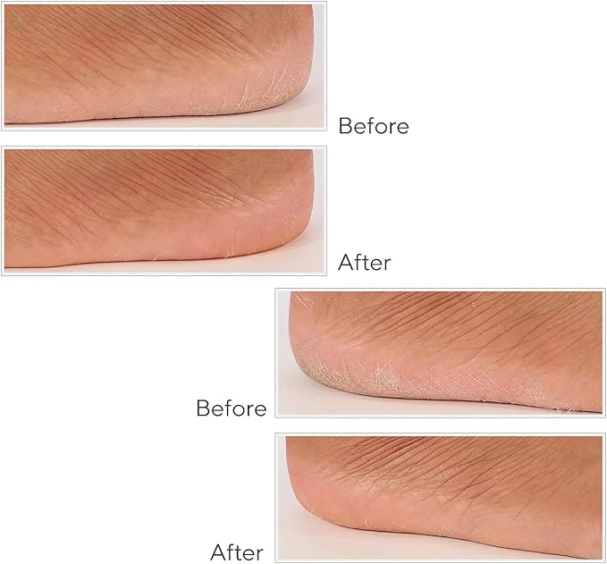 Spa-Rific 3pc Nano File Set: Professional Heavy Duty Glass Nail Files with Case Kit - Reusable Crystal Fingernail Manicure and Pedicure Tools for Men, Women, and Adults - Blue Ombre